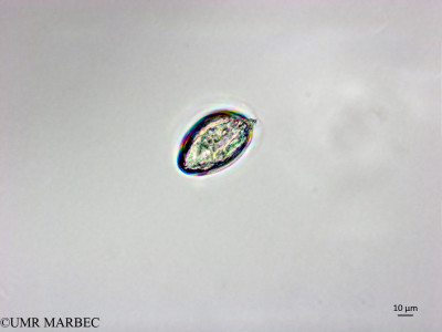 phyto/Brazilian_Nordeste/FernandodeNoronha_station1/ABRACOS1 October 2015/Dinophysis parvula (Snap-1362)(copy)_thumb.jpg